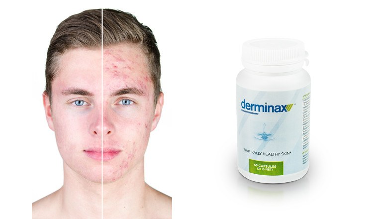 derminax-jak-dziala-efekty